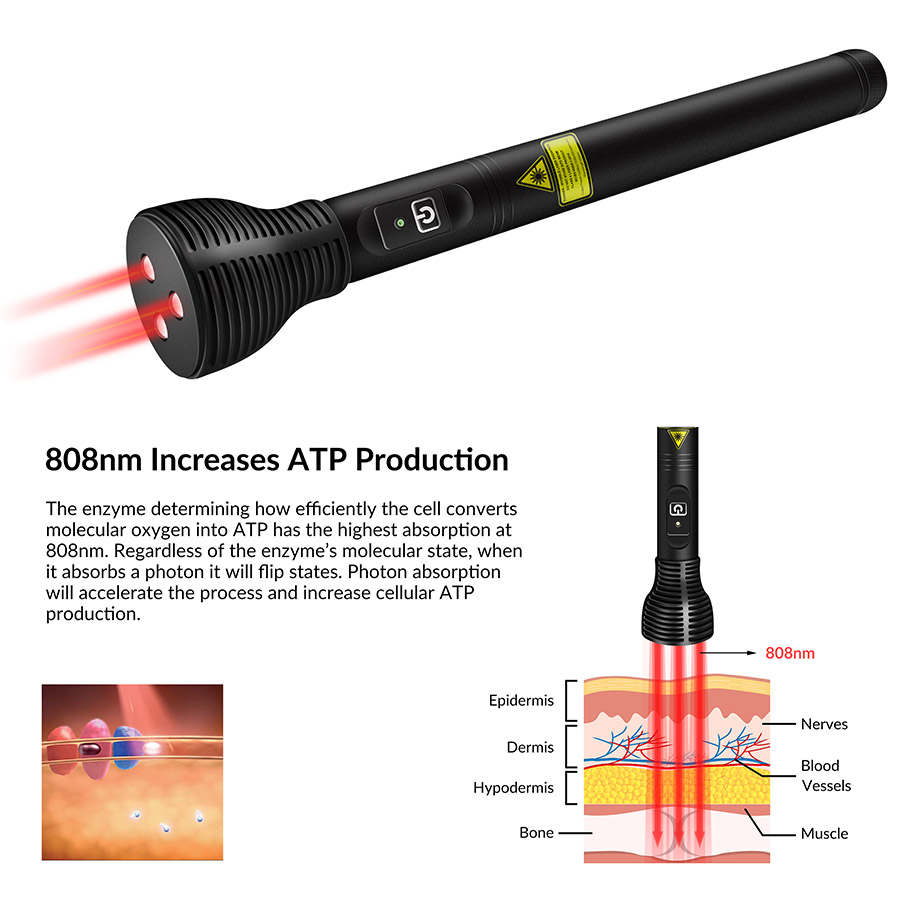 가정용 휴대형 808nm 적색광 치료기 냉각 레이저 침 - Red Light Therapy Device 리뷰 및 가격